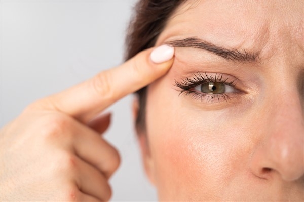 Göz kapağı düşüklüğü ciddi hastalıkların belirtisi olabilir