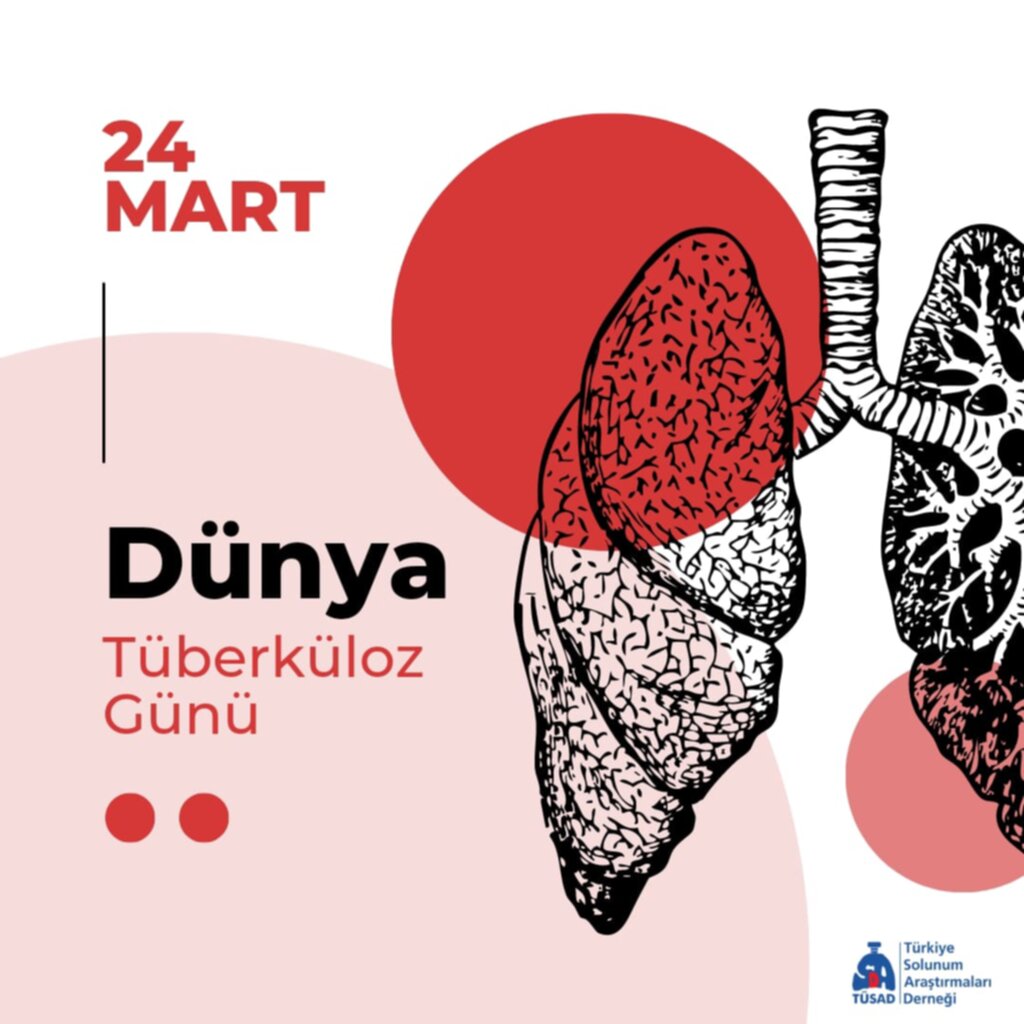 Türkiye’deki Tüberküloz Hastalarının Yüzde 12’si Deprem Bölgesinde Yaşıyor